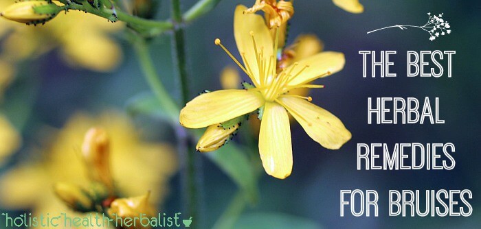 The Top Herbal Remedies for Bruises