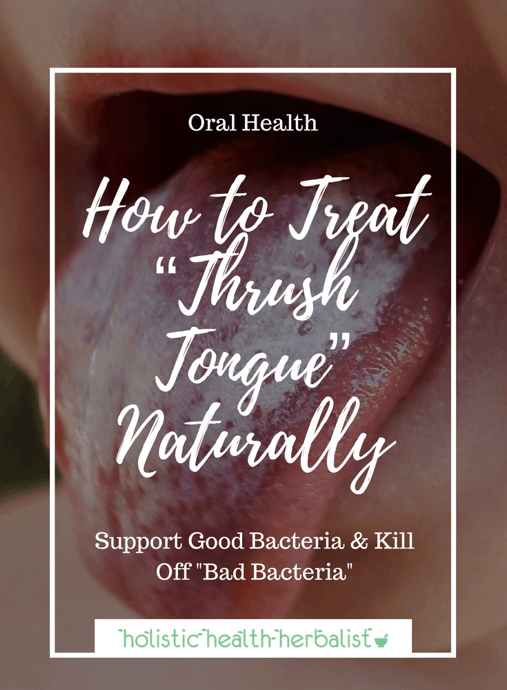 How to Treat "Thrush Tongue" Naturally - Holistic Health ...